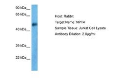 SLC17A3 Antibody, Novus Biologicals 100 &mu;L; Unconjugated:Antibodies,